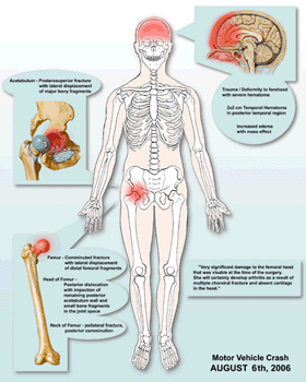 Medical Exhibit